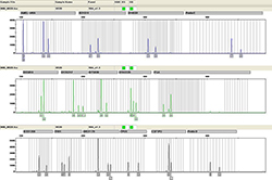 合肥迁户亲子鉴定哪里办理，合肥户籍亲子鉴定如何收费